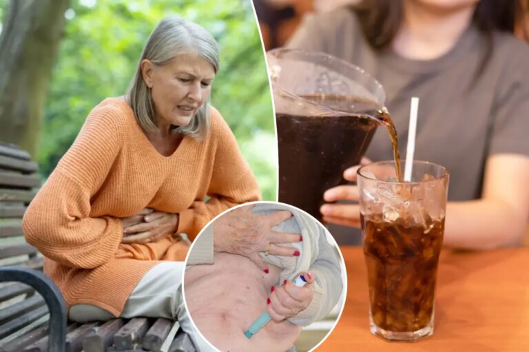 Surprising Cure: Diet Cola Resolves Stomach Mass Linked to GLP-1 Medication