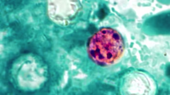 COUNTY-BY-COUNTY: Diarrhea-causing parasite flares up across Central Florida