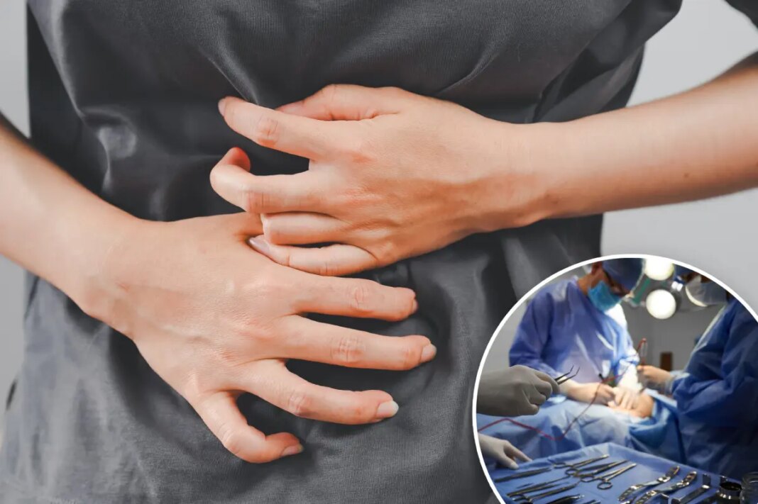 Doctor sews patient's organs together, creating 'closed loop' for poop