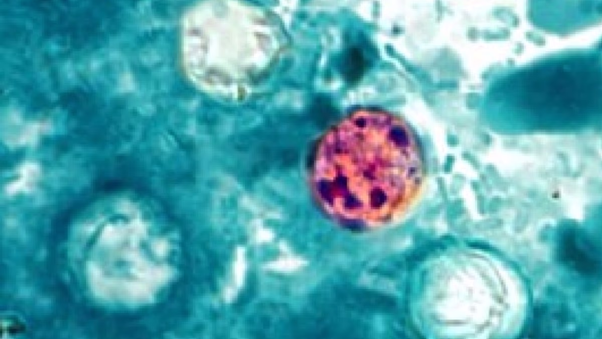 First deaths from parasite outbreak reported in Michigan