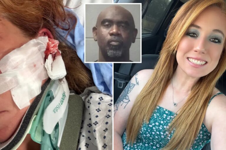 North Carolina DoorDash Driver Suffers Skull Fractures in Alleged Bat Attack