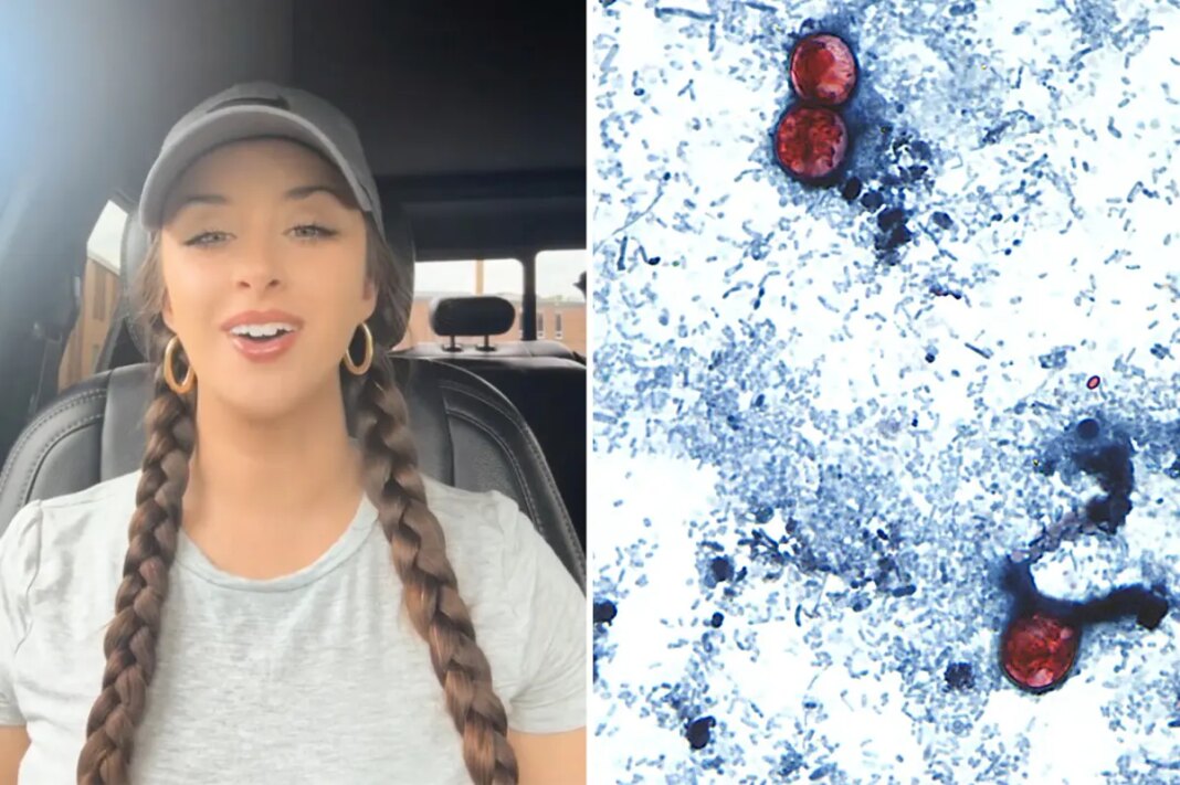 TikTok food critic Christina Hart details ‘miserable’ experience of contracting ‘explosive diarrhea’ parasite