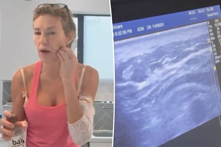 Brandi Glanville Claims Ultrasound Revealed Something Alive Moving in Her Face
