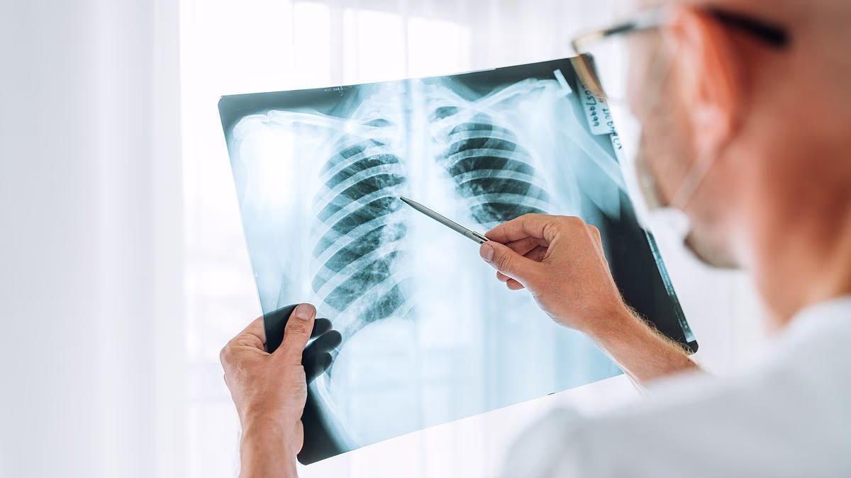 Map shows America lung cancer crisis may be sparked by hidden danger
