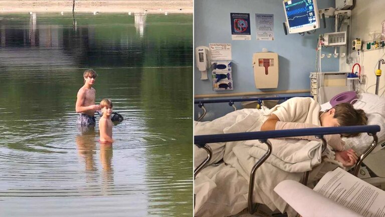 Maryland Family Speaks Out After Rabid 4-Foot Beaver Attacks 13-Year-Old Boy