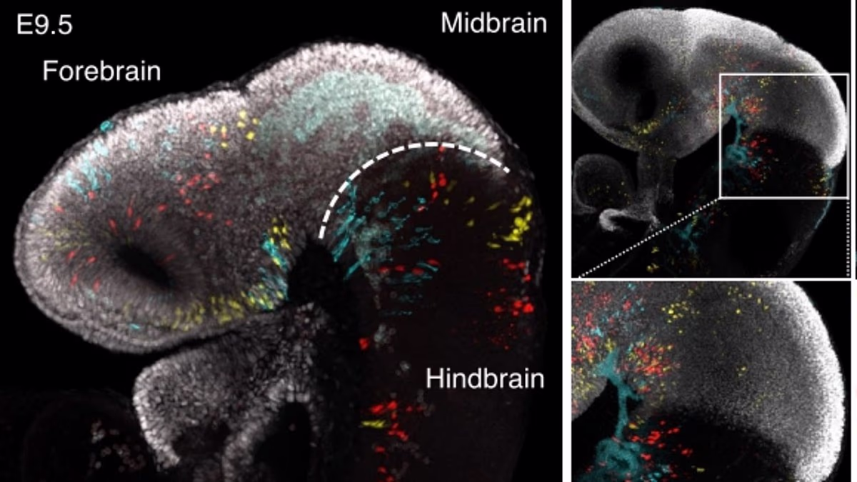The human brain is TWO separate organs, scientists reveal