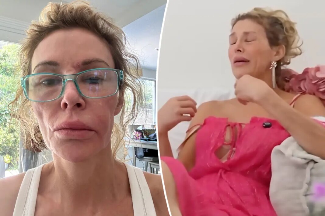‘Embarrassed’ Brandi Glanville breaks down in tears over GoFundMe: ‘I never thought I would do this’