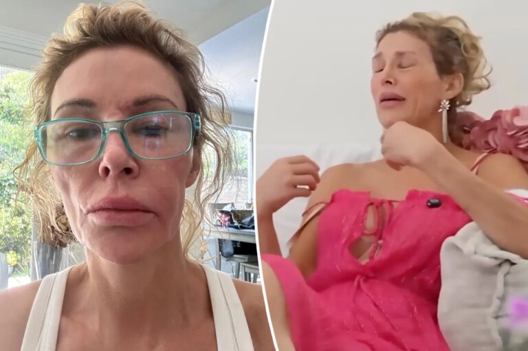 Brandi Glanville Tears Up Over GoFundMe: ‘I’m Embarrassed’