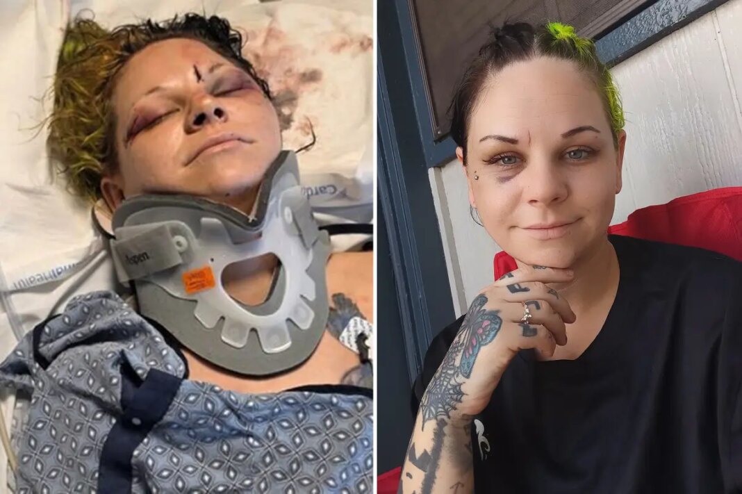 Bride-to-be stabbed in neck by fiancÃ© just weeks before wedding