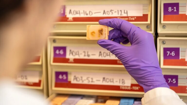 Fetal Tissue Supplier’s $765 Organ Fee Raises Illegal-Sale Concerns