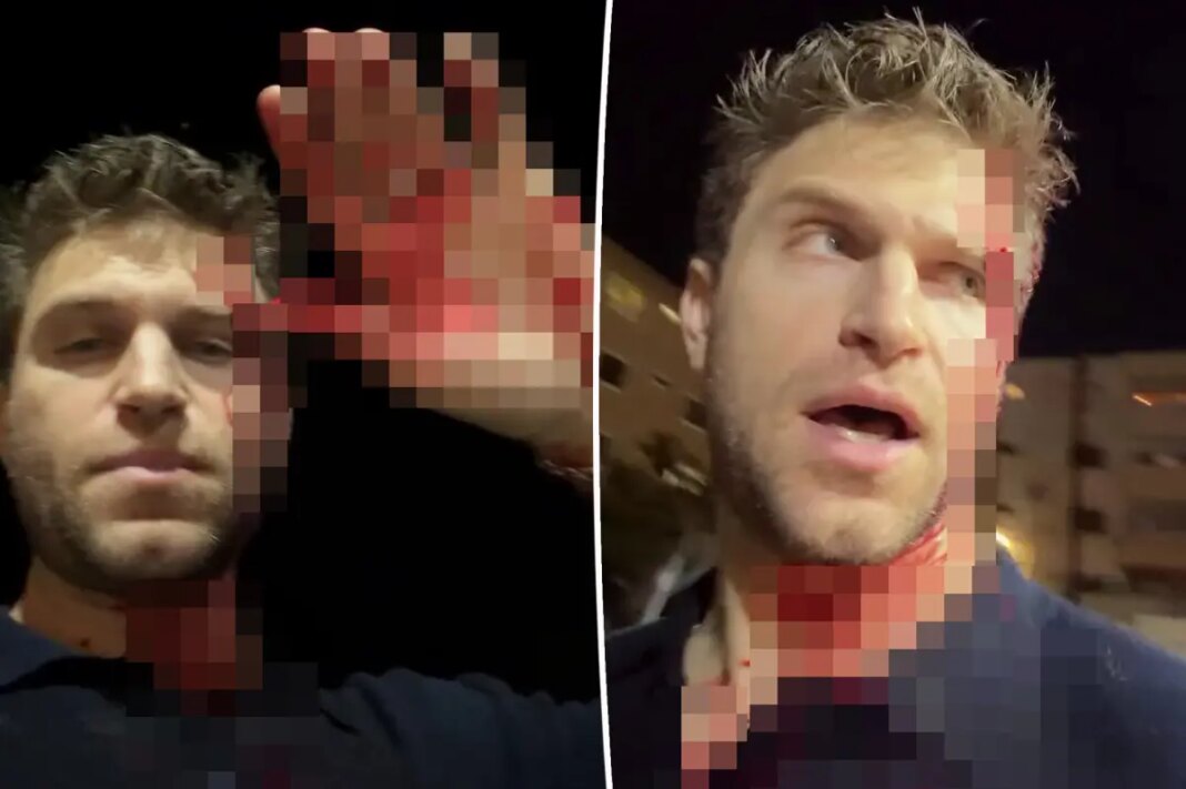 Keegan Allen 911 dispatch audio revealed after actor’s bloody LA grocery store attack