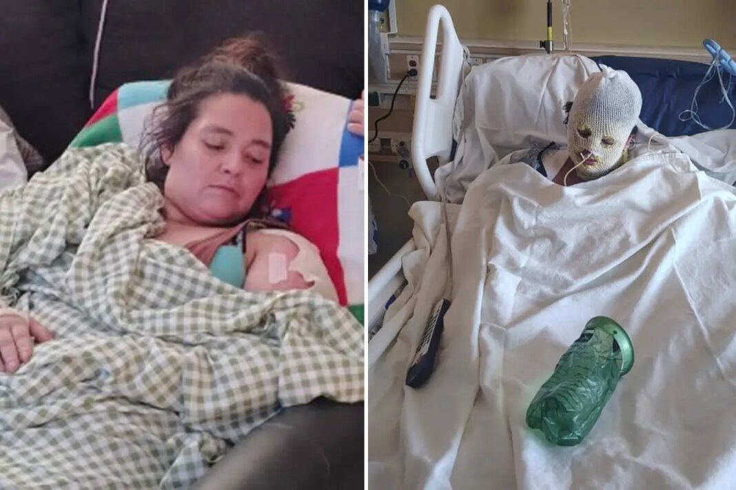 Kern County woman dies after being set on fire at encampment