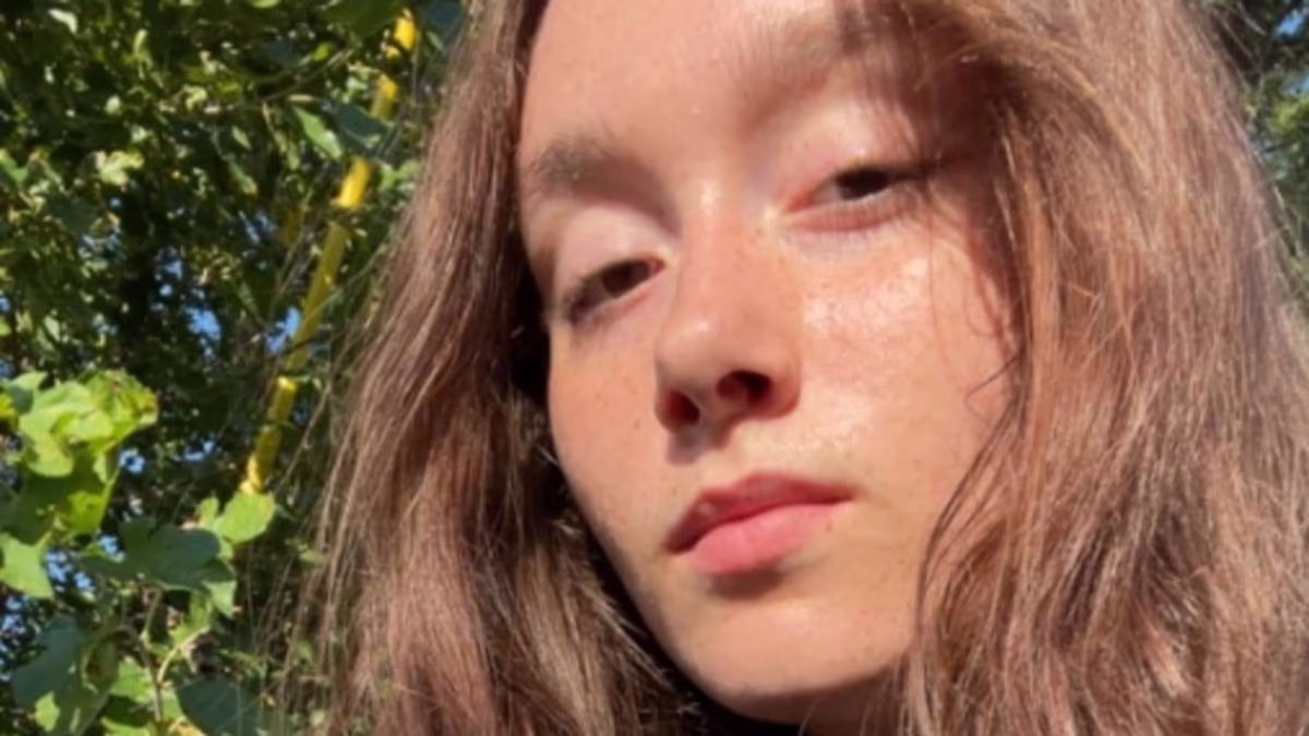 Missouri girl, 16, struck by deputy's car while lying on road at night