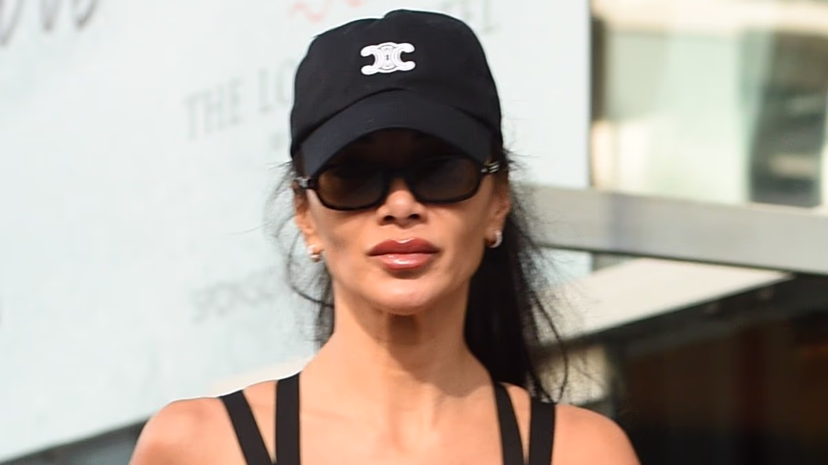 Nicole Scherzinger displays her burn injuries in Manchester
