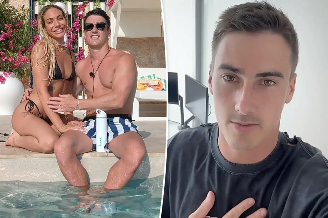 ‘Love Island’ star suffers horrific burns after falling into bonfire