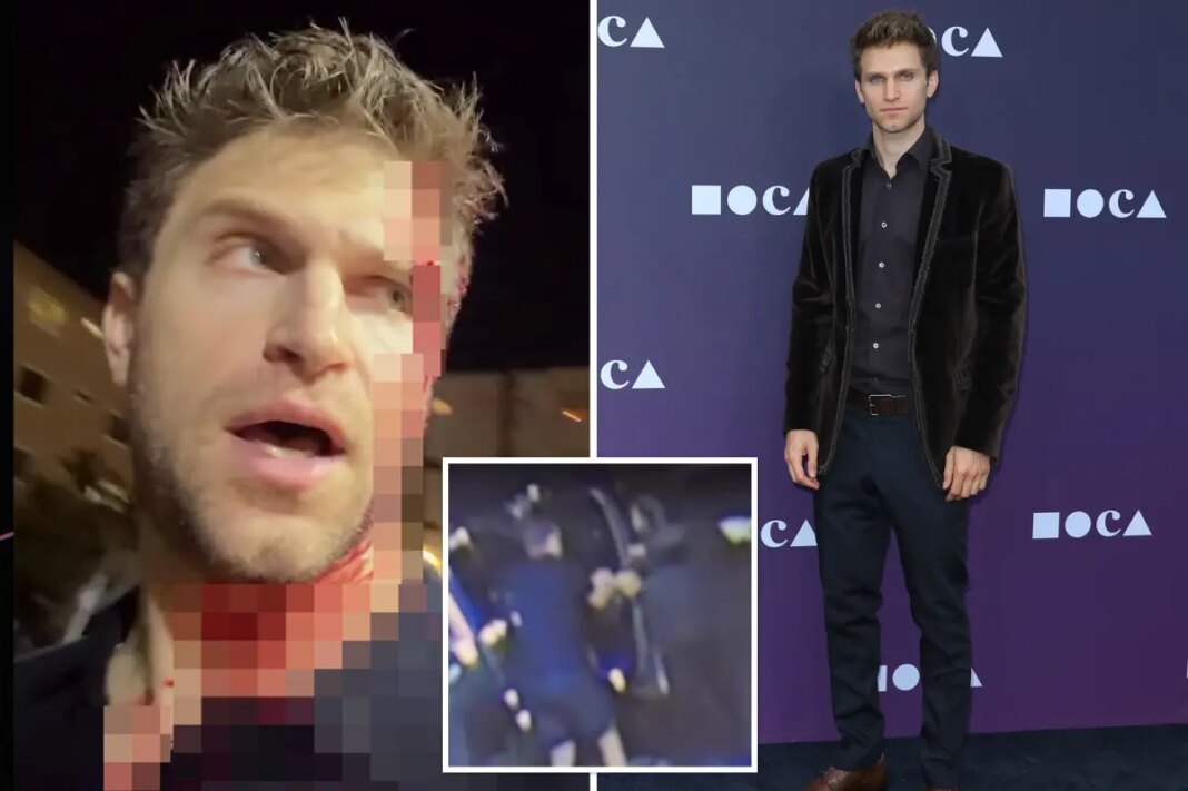 ‘Pretty Little Liars’ star blasts Gavin Newsom, Karen Bass after robbery